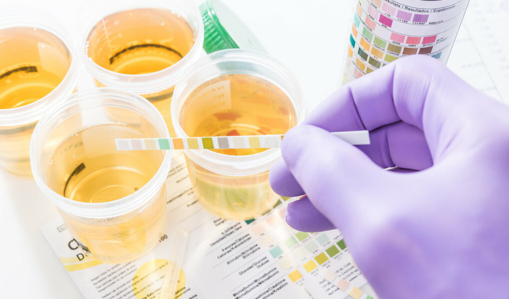 DO-CBD-GUMMY-BEARS-SHOW-UP-ON-A-DRUG-TEST_